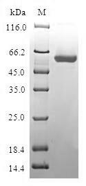 Biliverdin reductase A (BLVRA), human, recombinant