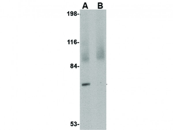 Anti-JPH4