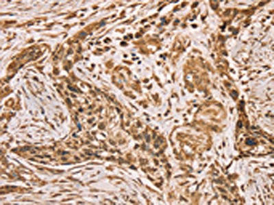 Anti-HIF1AN