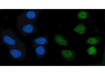 Anti-KLF10 / Krueppel-like factor 10 / TIEG-1