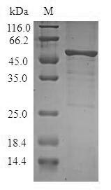 Serine/threonine-protein kinase 16 (STK16), human, recombinant