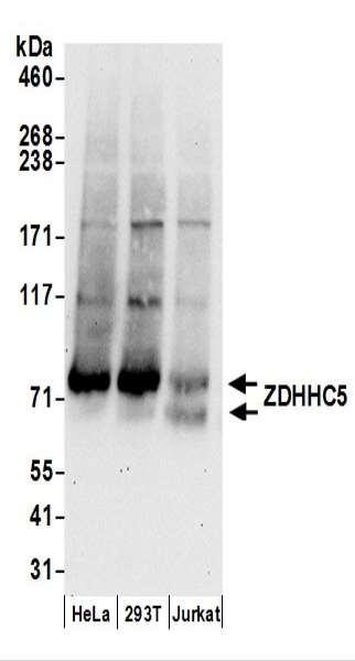 Anti-ZDHHC5