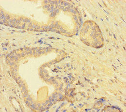 Anti-TMEM52B