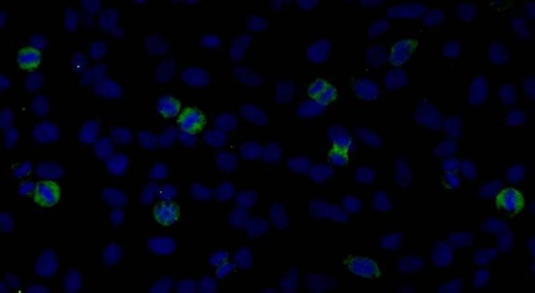 Anti-CENP-F/Mitosin (IHC)