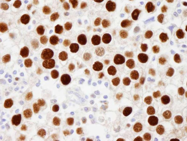 Anti-phospho-MCM2 (Ser108) (IHC)