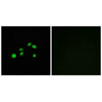 Anti-COL23A1