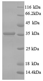 CD59 glycoprotein (CD59), human, recombinant