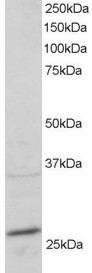 Anti-RAB11A / YL8, C-terminal