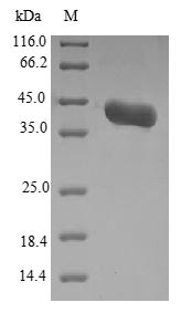 Agglutinin-like protein 3 (ALS3), partial, Candida albicans, recombinant
