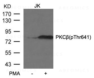 Anti-phospho-PKCbeta (Thr641)