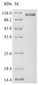 Procollagen-lysine,2-oxoglutarate 5-dioxygenase 2 (PLOD2), recombinant human