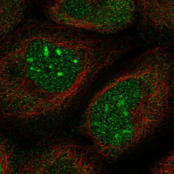 Anti-SPOCD1