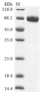 Mothers against decapentaplegic homolog 6 (SMAD6), human, recombinant