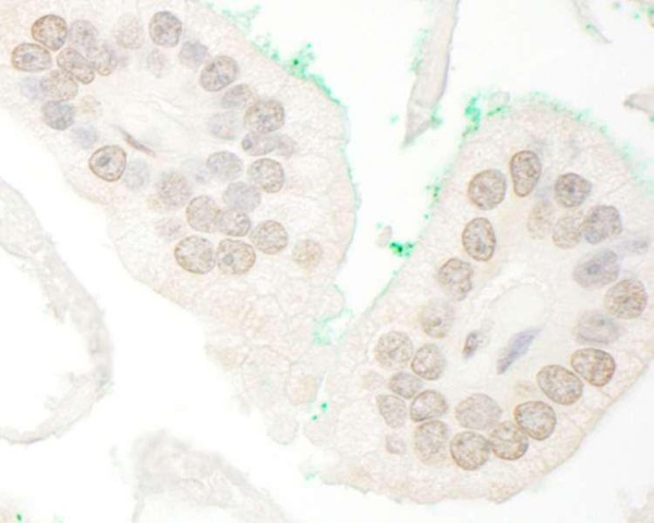 Anti-ARA70 (IHC)