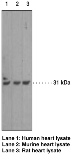 Anti-Caspase-3 (Clone 31A1067)