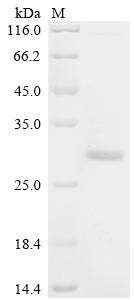 Polyprotein P1234, partial, Semliki forest virus, recombinant