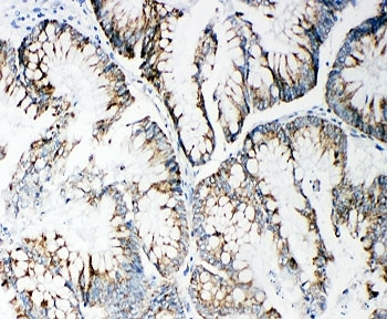 Anti-MMP14