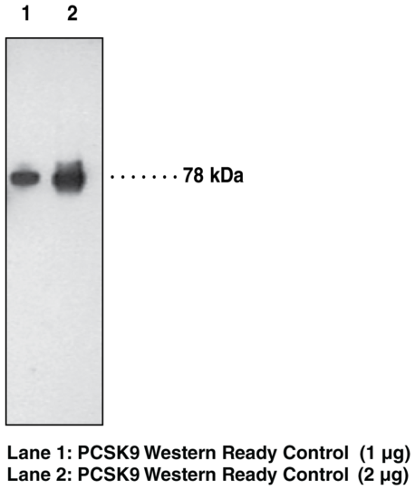 Anti-PCSK9 (Clone 15A6)