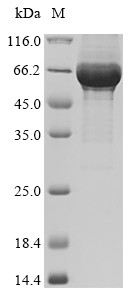 Glycoprotein (G), partial, Rabies virus, recombinant