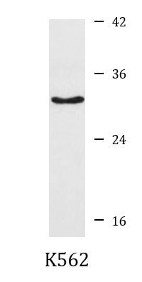 Anti-Cathepsin H