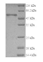 T-complex protein 1 subunit beta (CCT2), human, recombinant