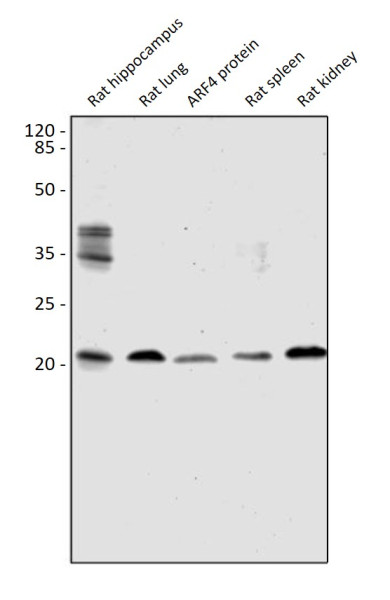 Anti-ARF4