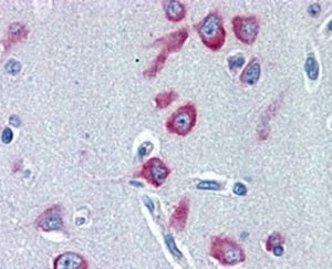 Anti-PCK1