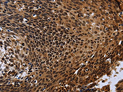 Anti-FHL3