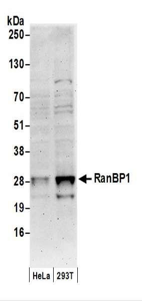 Anti-RanBP1