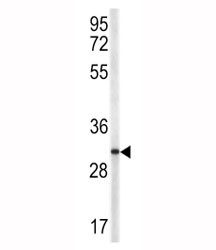 Anti-CD40L (TRAP)