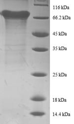 Eukaryotic initiation factor 4A-II (EIF4A2), human, recombinant