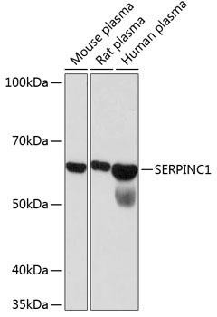 Anti-SERPINC1