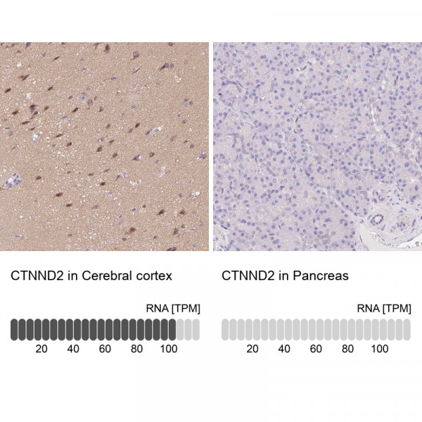 Anti-CTNND2