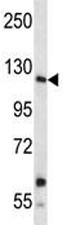 Anti-Insulin Receptor R (INSRR)