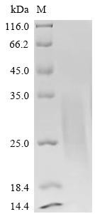 Parathyroid hormone/parathyroid hormone-related peptide receptor (Pth1r), partial, recombinant rat