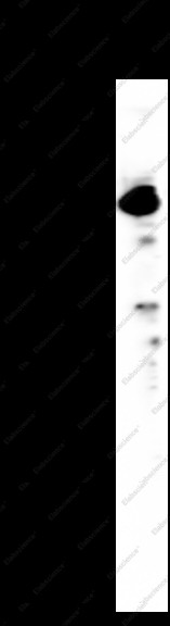 Anti-Recombinant CD141, clone C312253