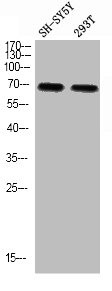 Anti-Phospho-SF1 (S82)