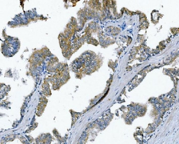Anti-Poliovirus Receptor / PVR