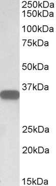 Anti-CD20, C-terminal