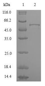 Heterogeneous nuclear ribonucleoproteins A2/B1 (HNRNPA2B1), human, recombinant
