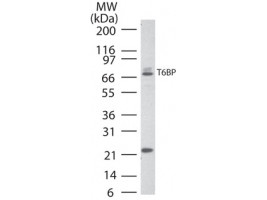 Anti-TRAF6 Binding Protein