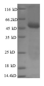 Carbonic anhydrase 12 (CA12), partial, human, recombinant
