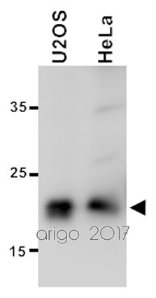 Anti-alpha B Crystallin