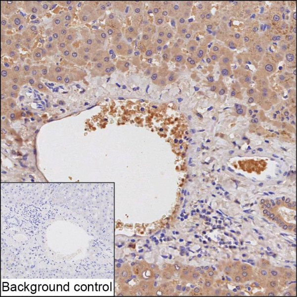 Anti-LYSMD1