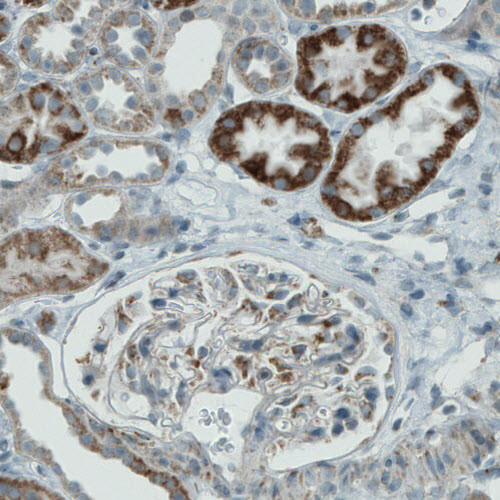 Anti-PGAM5, clone CL0624