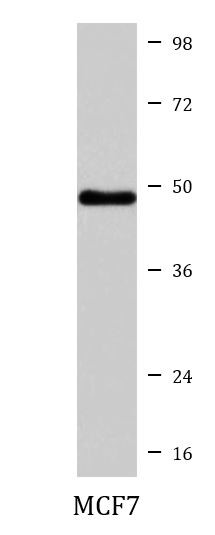 Anti-SERPINA9 / GCET1