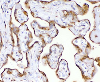 Anti-TIMP2, clone MPIB2-1R