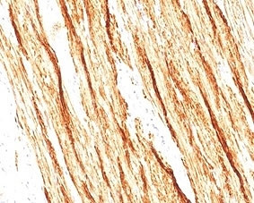 Anti-Smoothelin / SMSMO / SMTN, clone SMTN/2320R