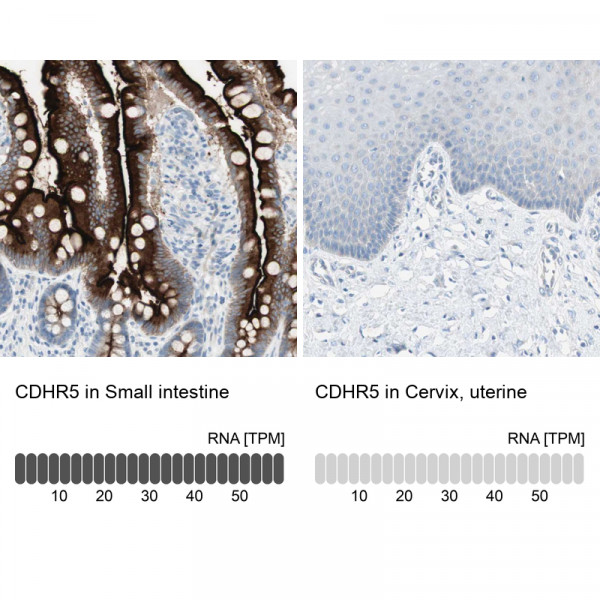 Anti-CDHR5