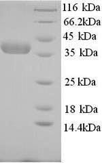 Nicotinate phosphoribosyltransferase (NAPRT), partial, human, recombinant